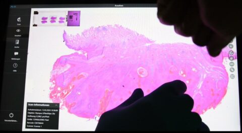 ARGOS Slide Scanner Systems